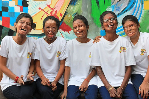 THE PLIGHT OF ACID VICTIMS